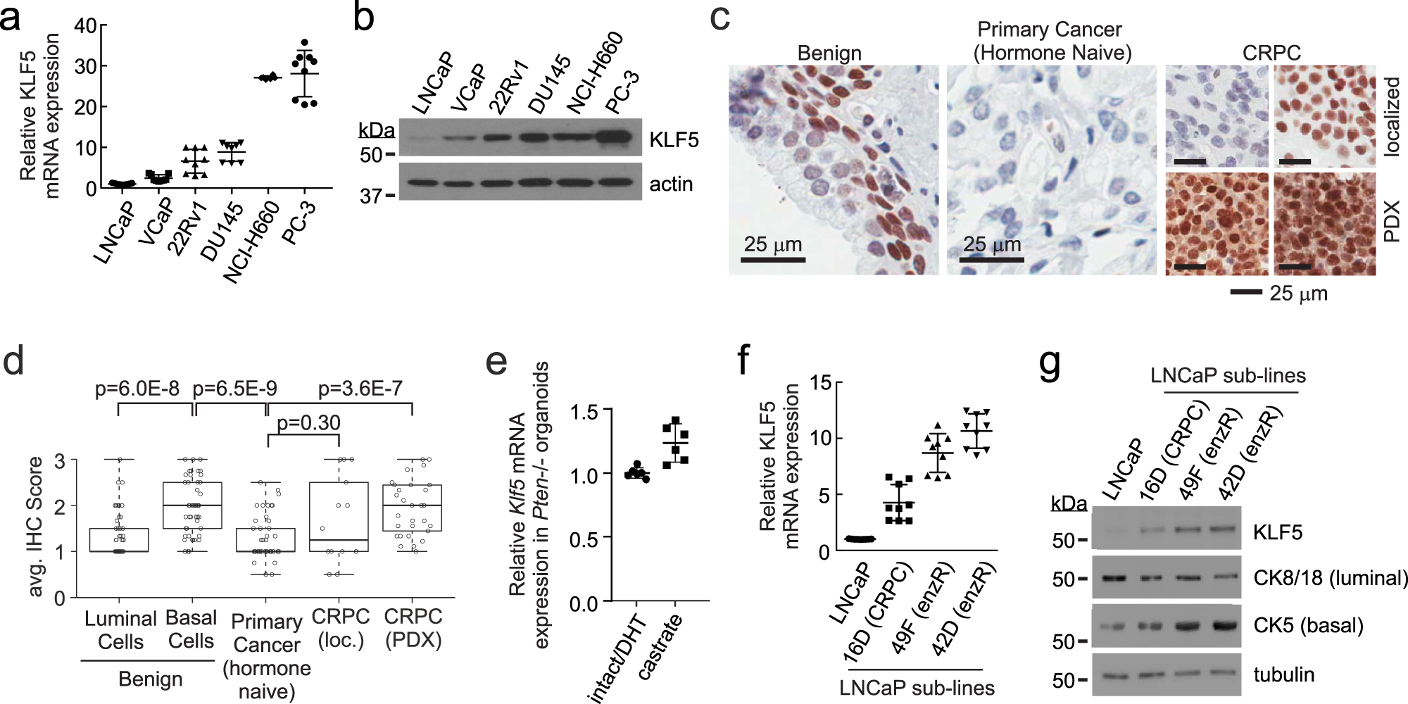 Opposing transcriptional programs of KLF5 and AR emerge during therapy for advanced prostate cancer preview