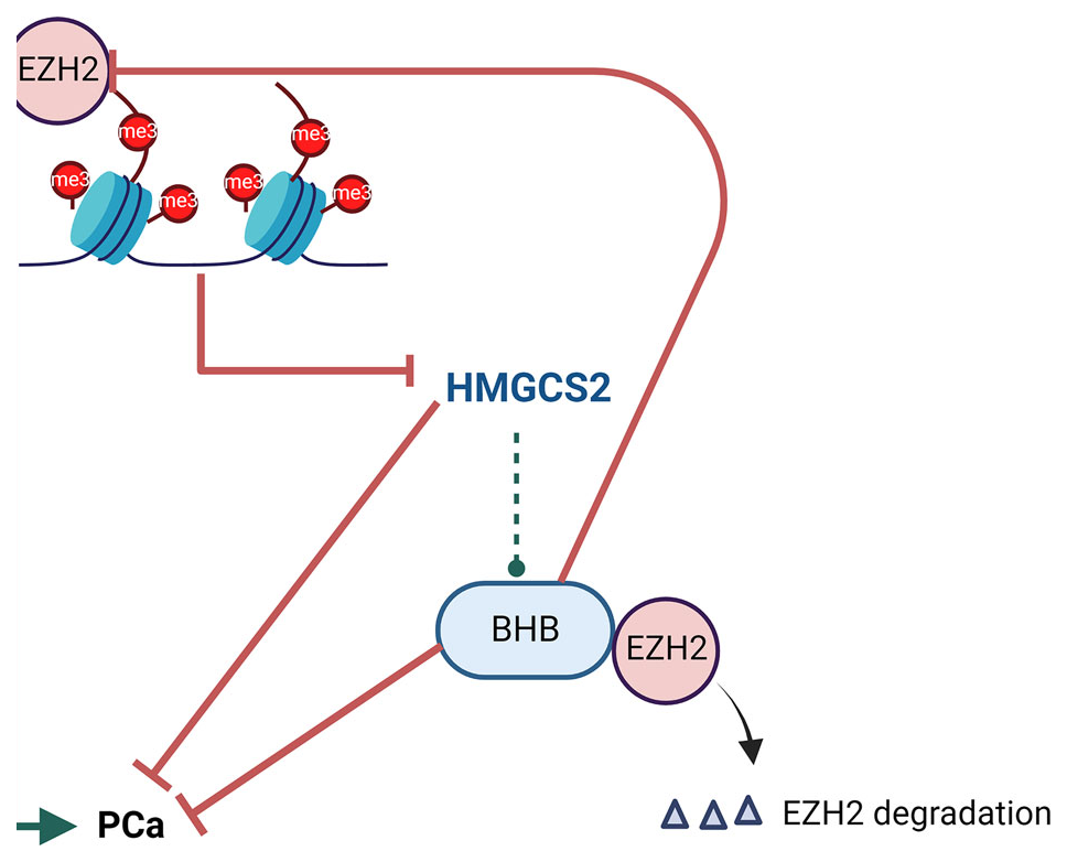 Ketone drink enhances therapeutic efficacy in prostate cancer by targeting EZH2 preview