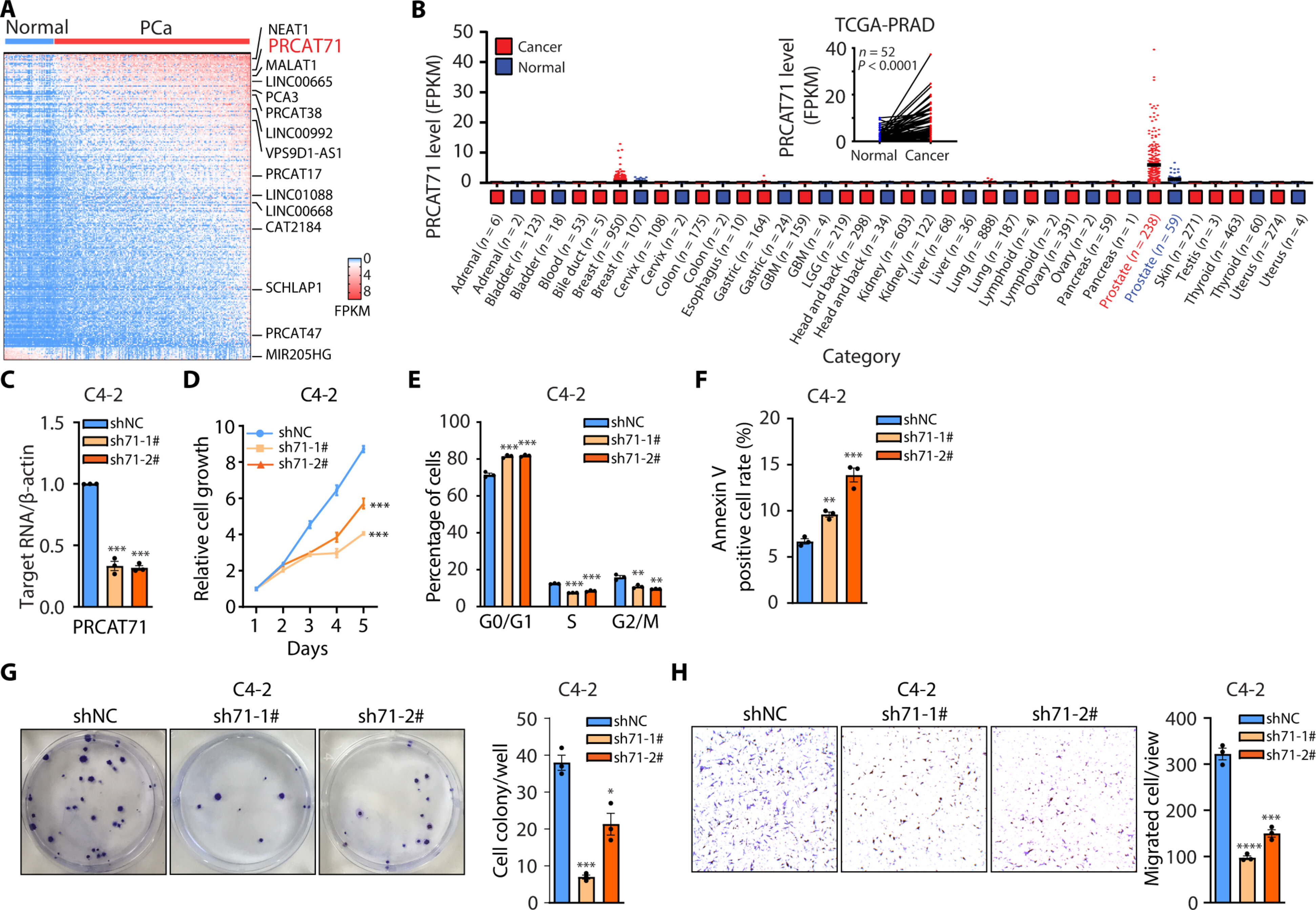 Androgen receptor-regulated lncRNA PRCAT71 promotes AR signaling through the interaction with KHSRP in prostate cancer preview